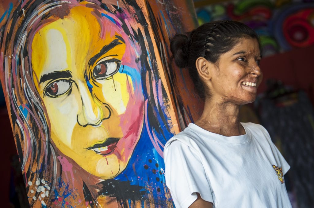 An acid attack survivor working at Sheroes Hangout in India | © Barcroft Media/Getty Images